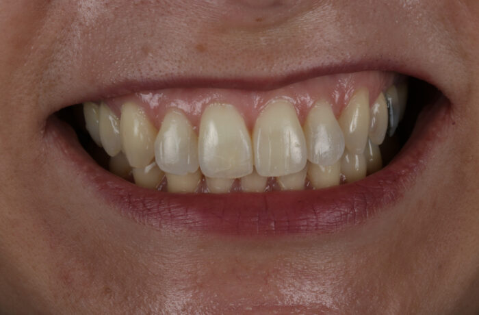 After - Cheadle Hulme Dental