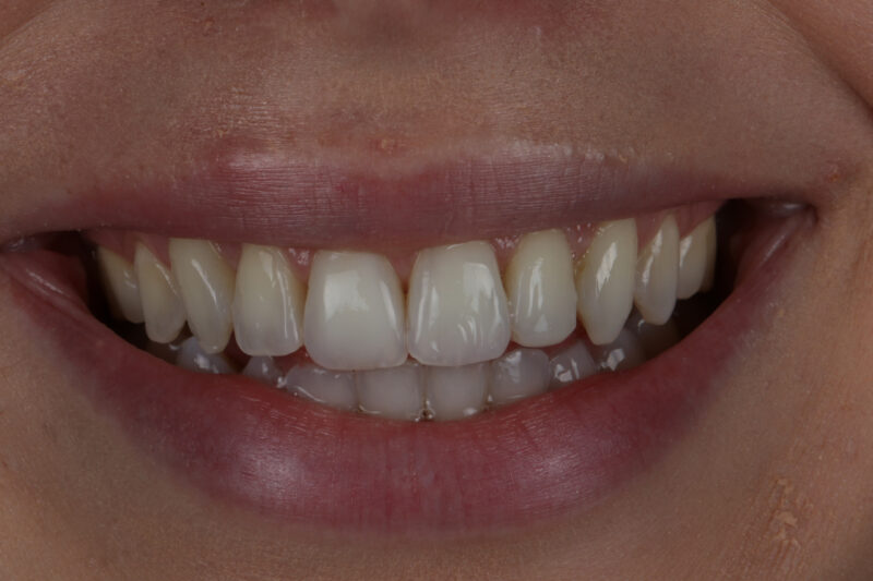 After - Cheadle Hulme Dental