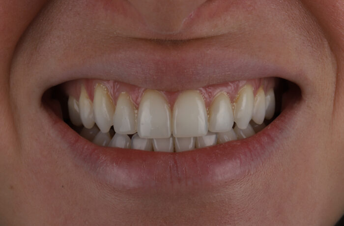 After - Cheadle Hulme Dental