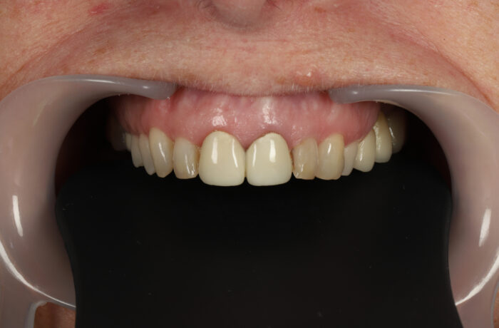 Before - Cheadle Hulme Dental