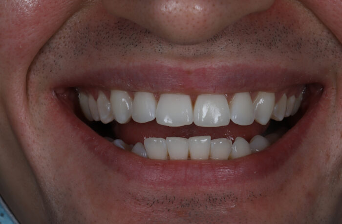 After - Cheadle Hulme Dental