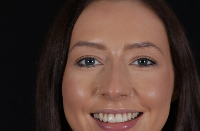 After - Cheadle Hulme Dental