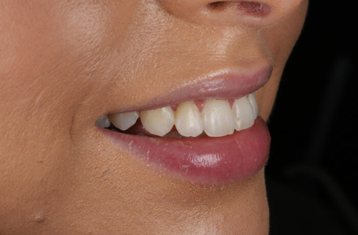 After - Cheadle Hulme Dental