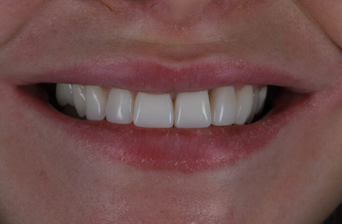 After - Cheadle Hulme Dental