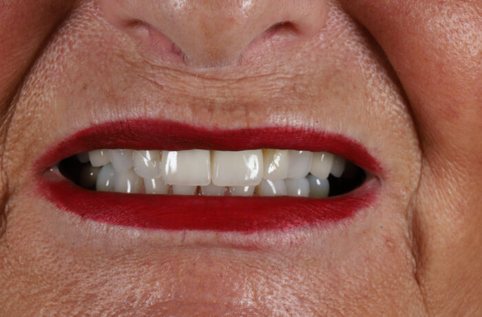 After - Cheadle Hulme Dental