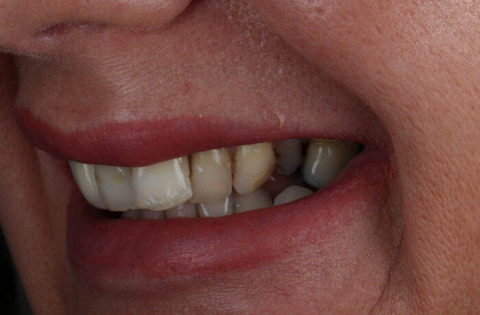 Before - Cheadle Hulme Dental