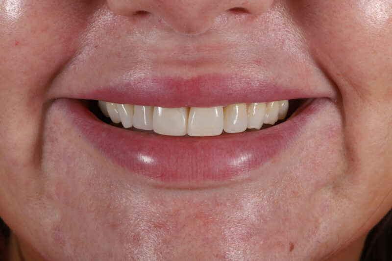 After - Cheadle Hulme Dental