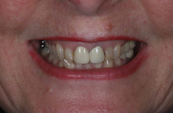 Before - Cheadle Hulme Dental