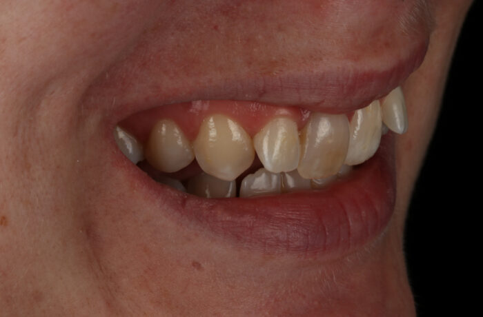 Before - Cheadle Hulme Dental