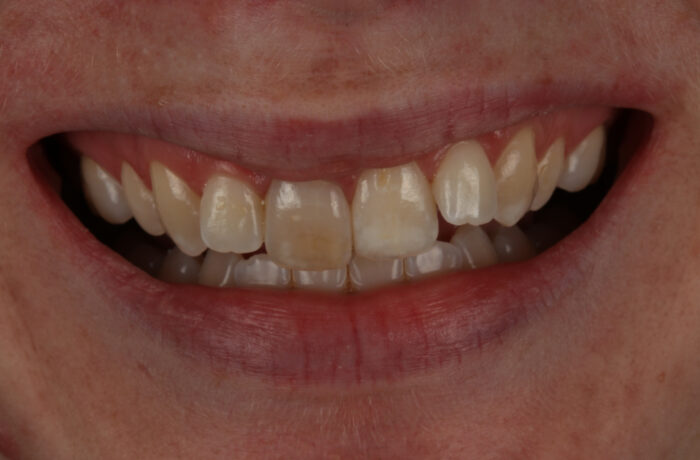 Before - Cheadle Hulme Dental