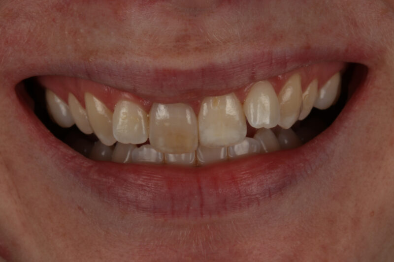 Before - Cheadle Hulme Dental