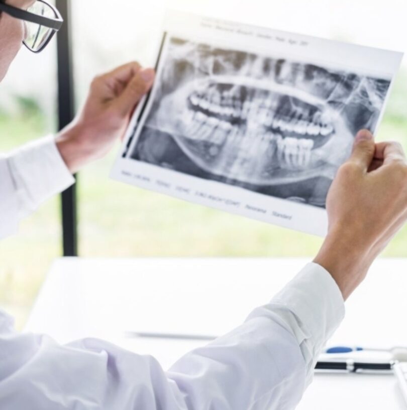 are dental X-rays necessary