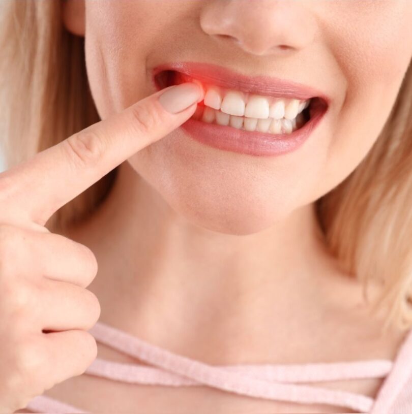 gum disease and diabetes - the surprising link