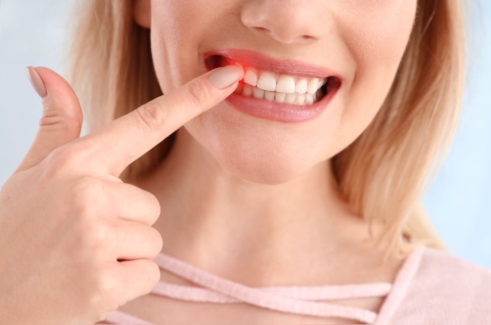 tooth discolouration after trauma- patient pointing to the relevant tooth