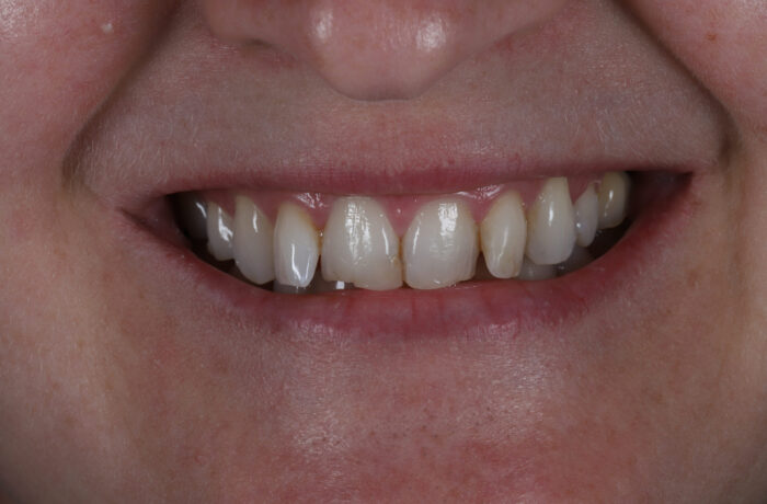 Before - Cheadle Hulme Dental