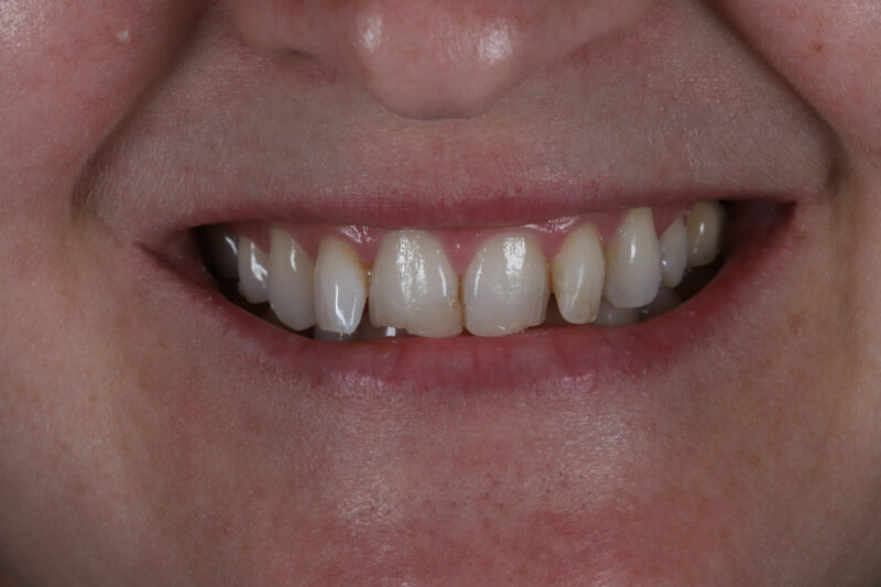 Before - Cheadle Hulme Dental