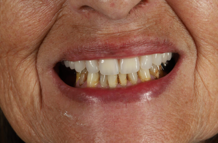 After - Cheadle Hulme Dental