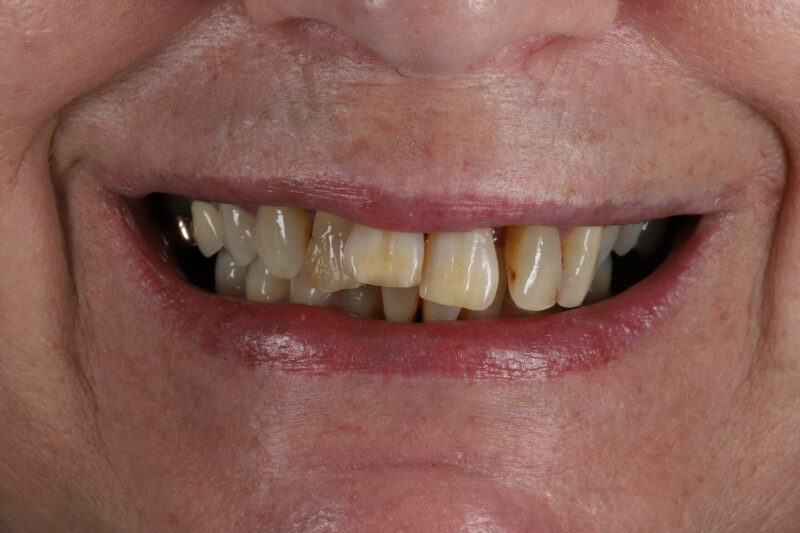 Before - Cheadle Hulme Dental