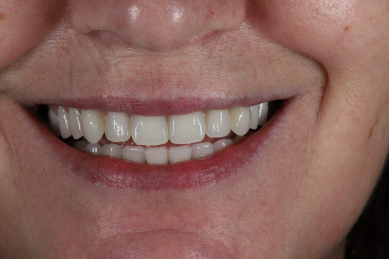 After - Cheadle Hulme Dental