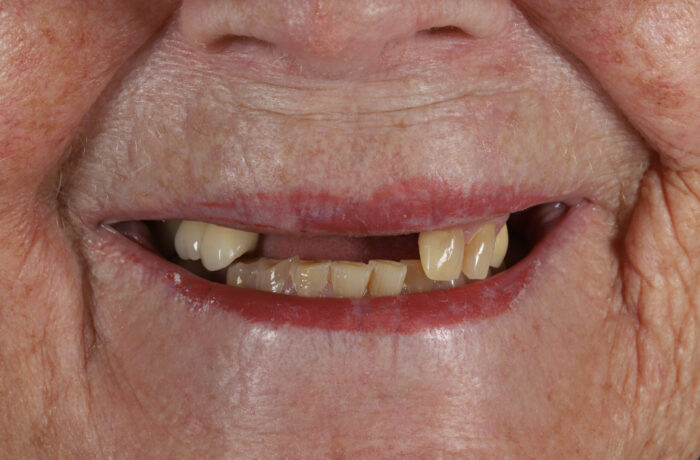 Before - Cheadle Hulme Dental