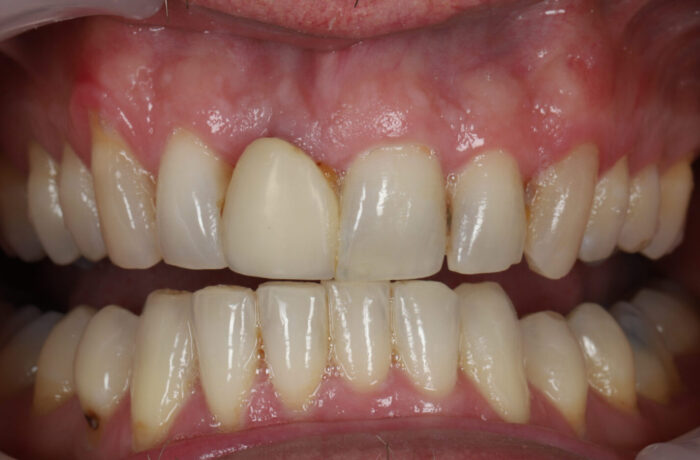 Before - Cheadle Hulme Dental