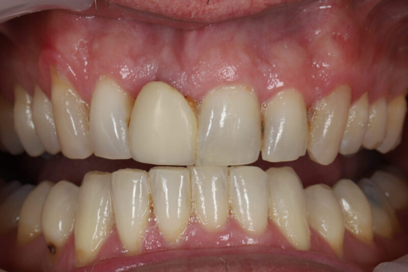 Before - Cheadle Hulme Dental