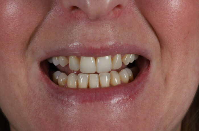 After - Cheadle Hulme Dental