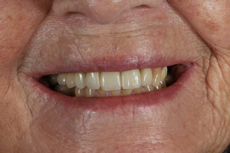 After - Cheadle Hulme Dental