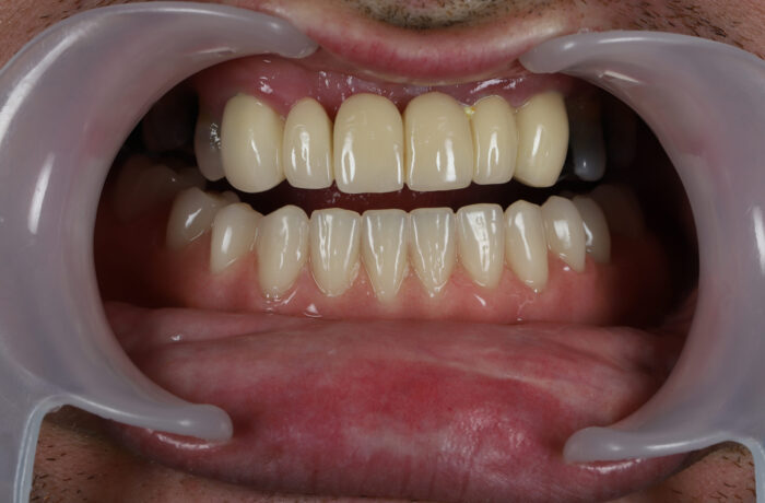 After - Cheadle Hulme Dental