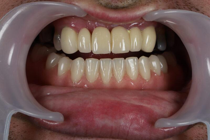 After - Cheadle Hulme Dental