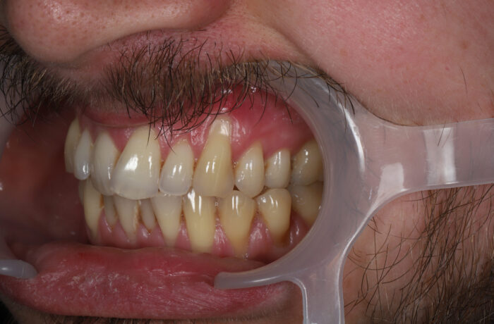 Before - Cheadle Hulme Dental