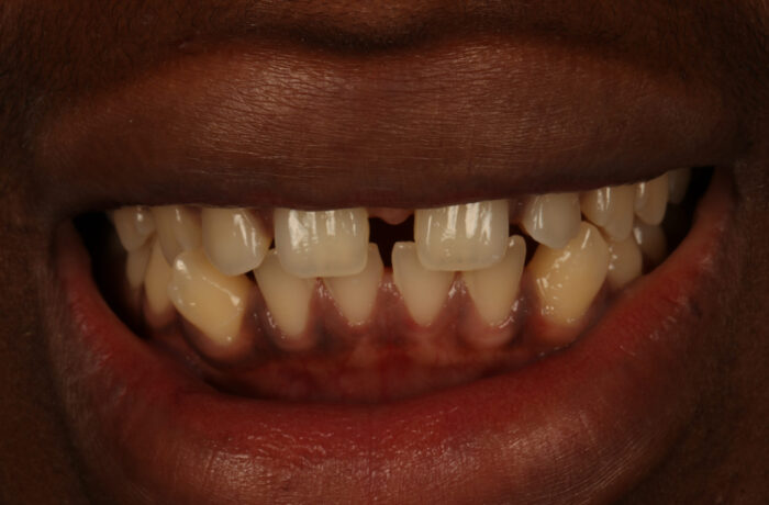 Before - Cheadle Hulme Dental