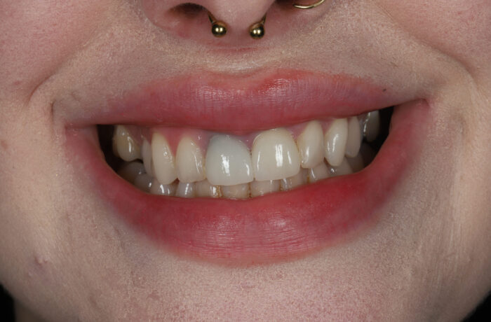 Before - Cheadle Hulme Dental