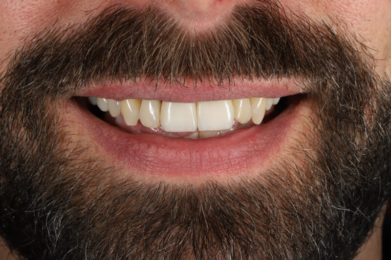 After - Cheadle Hulme Dental