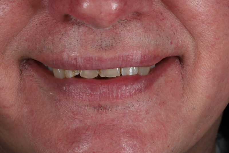 After - Cheadle Hulme Dental