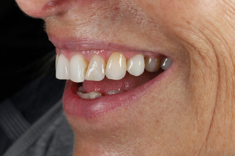 After - Cheadle Hulme Dental