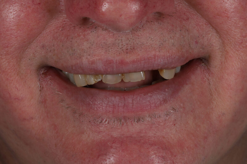 Before - Cheadle Hulme Dental