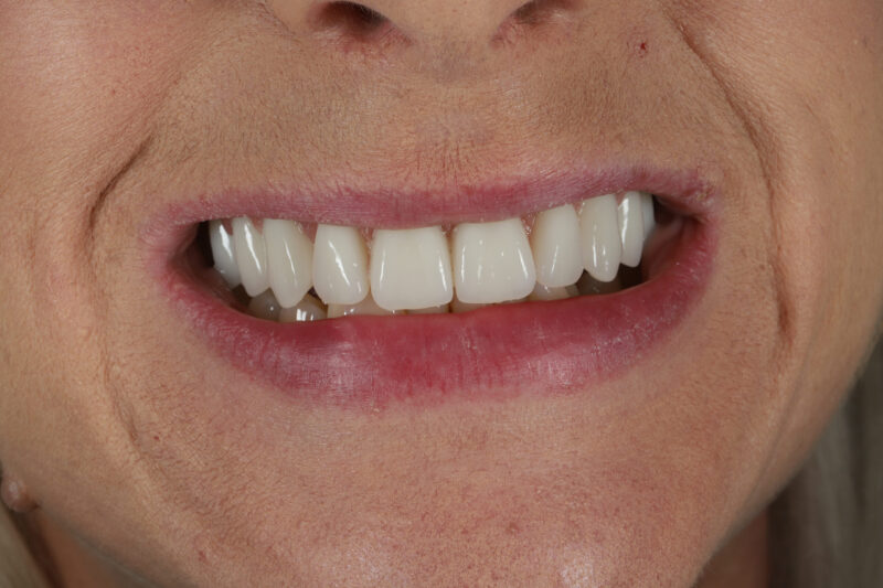 After - Cheadle Hulme Dental