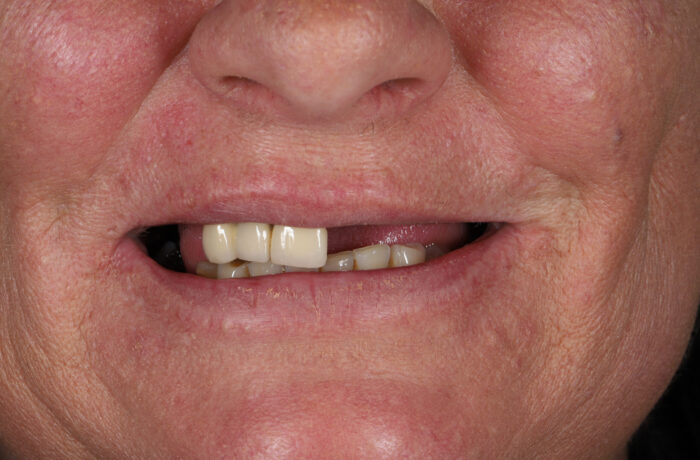 Before - Cheadle Hulme Dental