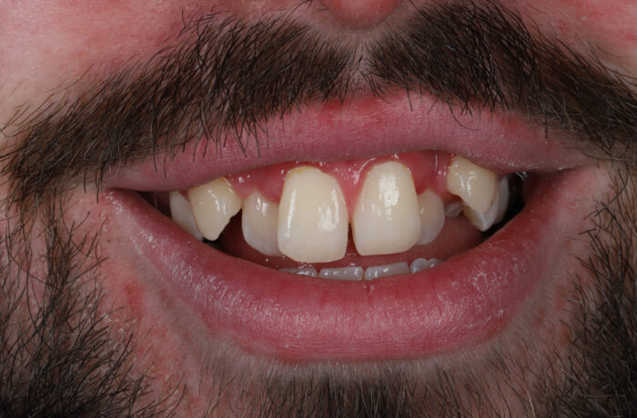 Before - Cheadle Hulme Dental