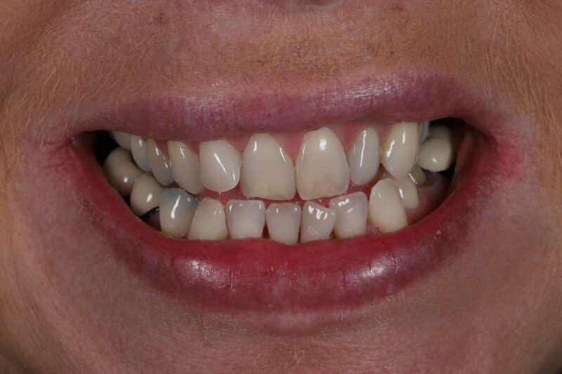 Before - Cheadle Hulme Dental