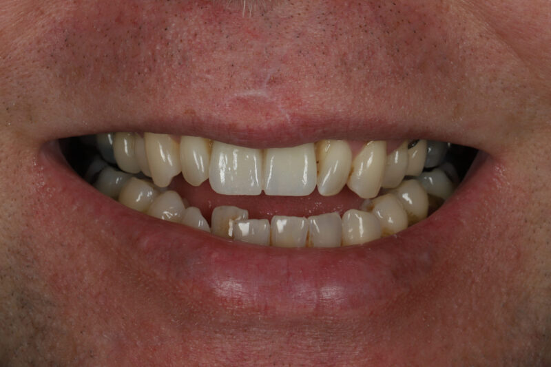 After - Cheadle Hulme Dental