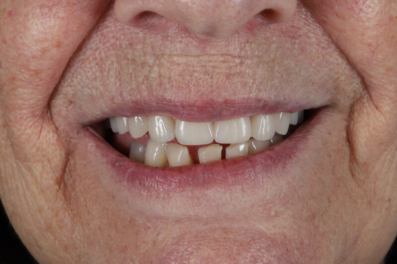 After - Cheadle Hulme Dental