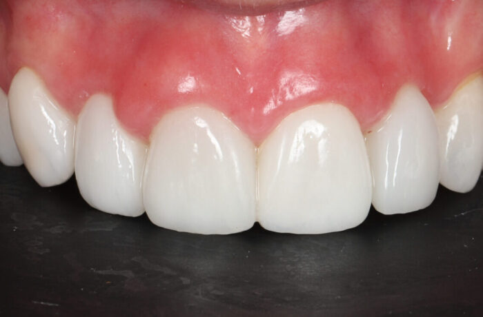 After - Cheadle Hulme Dental