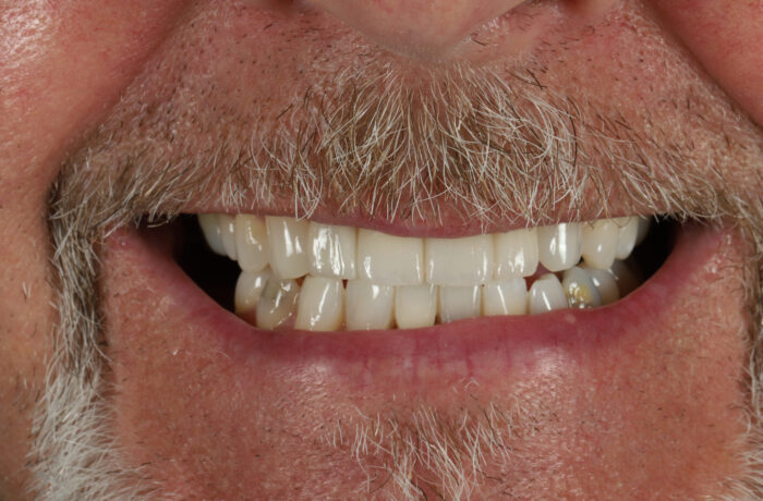 After - Cheadle Hulme Dental