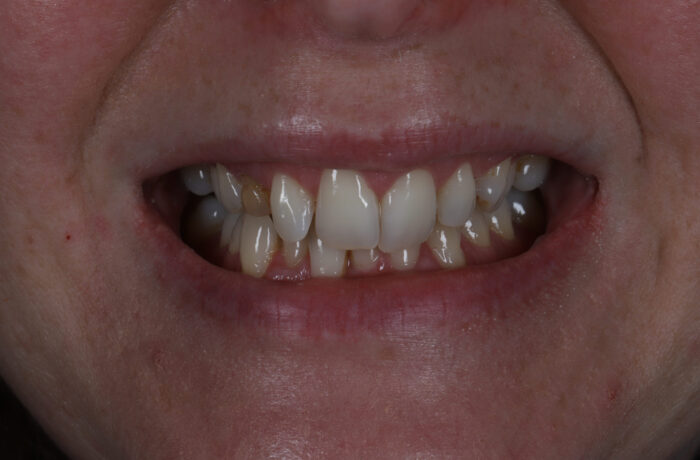 Before - Cheadle Hulme Dental