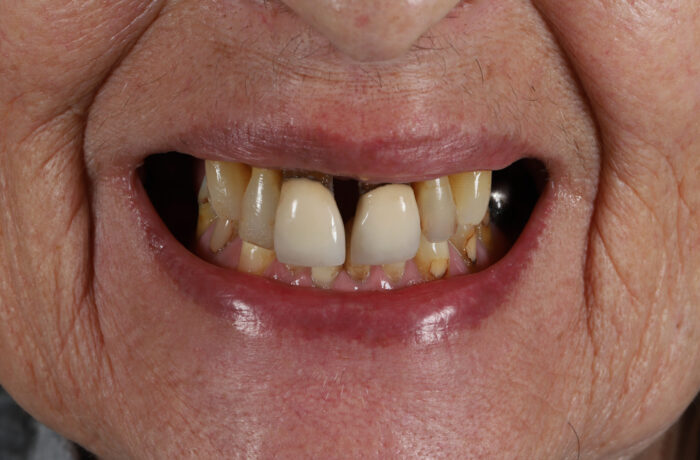 Before - Cheadle Hulme Dental