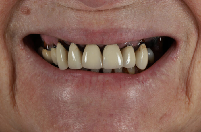 Before - Cheadle Hulme Dental