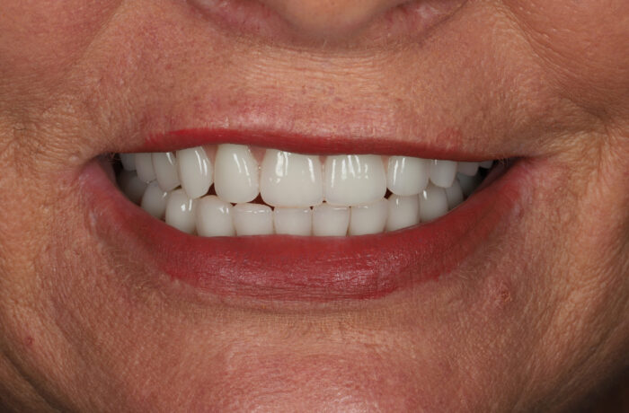 After - Cheadle Hulme Dental