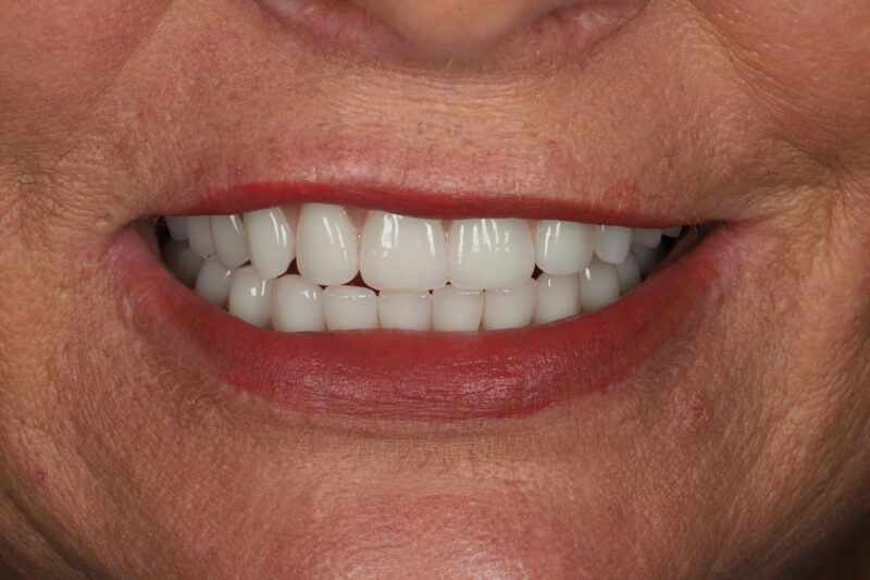 After - Cheadle Hulme Dental